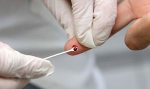 O exame com fluido utiliza metodologia diferente do teste feito com amostra de sangue. Foto: Divulgação